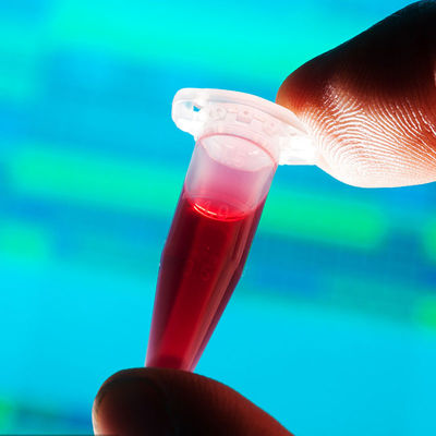 FDA의 승인을 받시험소 고속 검출 푸드 접촉 아기 우유병 제 3자 인증 서비스